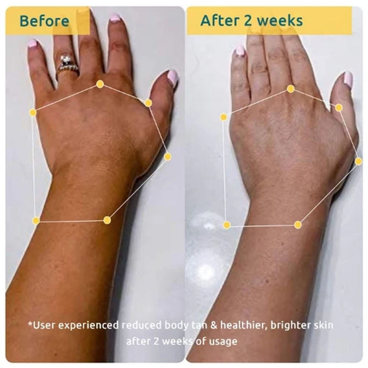 Wishcare Bodycare Pigmentation Duo