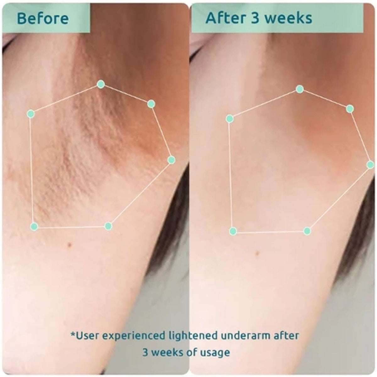 Wishcare Bodycare Pigmentation Duo