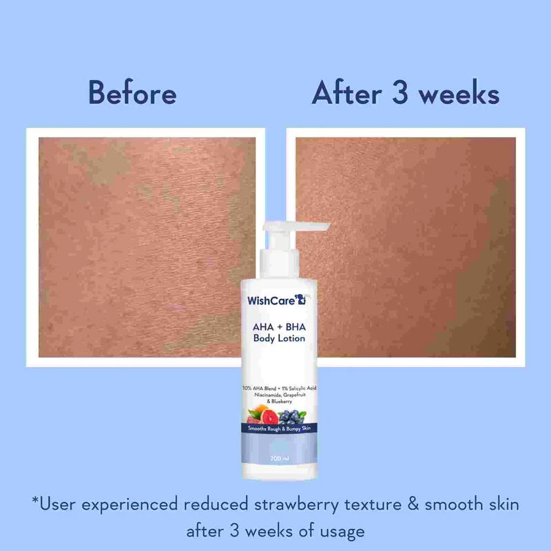 WishCare AHA + BHA Body Lotion 200ml