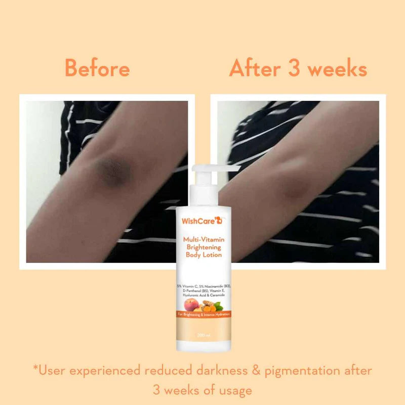 Wishcare Multi Vitamin Brightening Body Lotion - 200ml