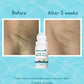 Wishcare Under Arm Roll On Serum | 50ml