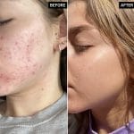 THE INKEY LIST NIACINAMIDE SERUM 30ML - Image 2