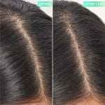 The Inkey List salicylic acid exfoliating scalp treatment 150ml - Image 2