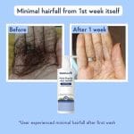 Wishcare Multi-Peptide Anti Hairfall Shampoo | 250ml - Image 3