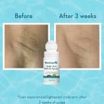 Wishcare Under Arm Roll On Serum | 50ml - Image 3